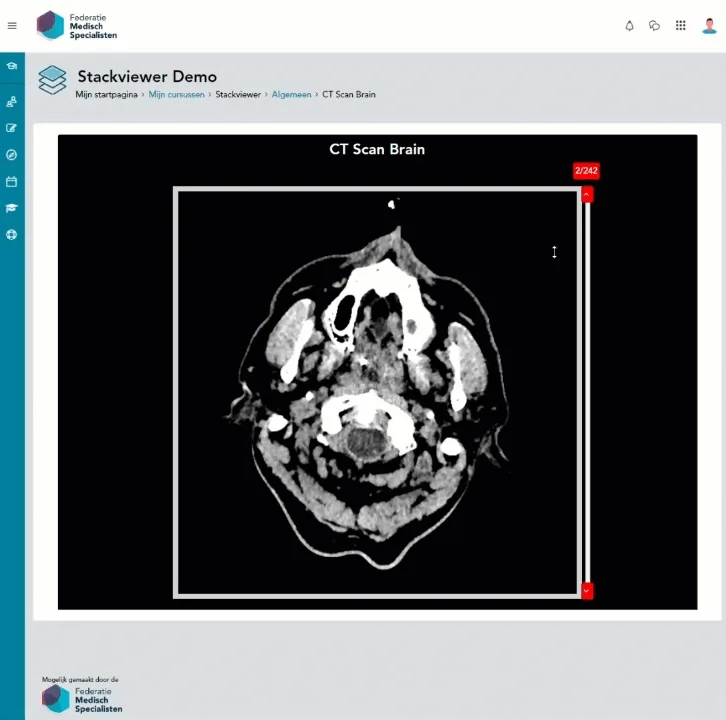 Stackviewer - Medische beeldstacks - Schermafbeelding 2